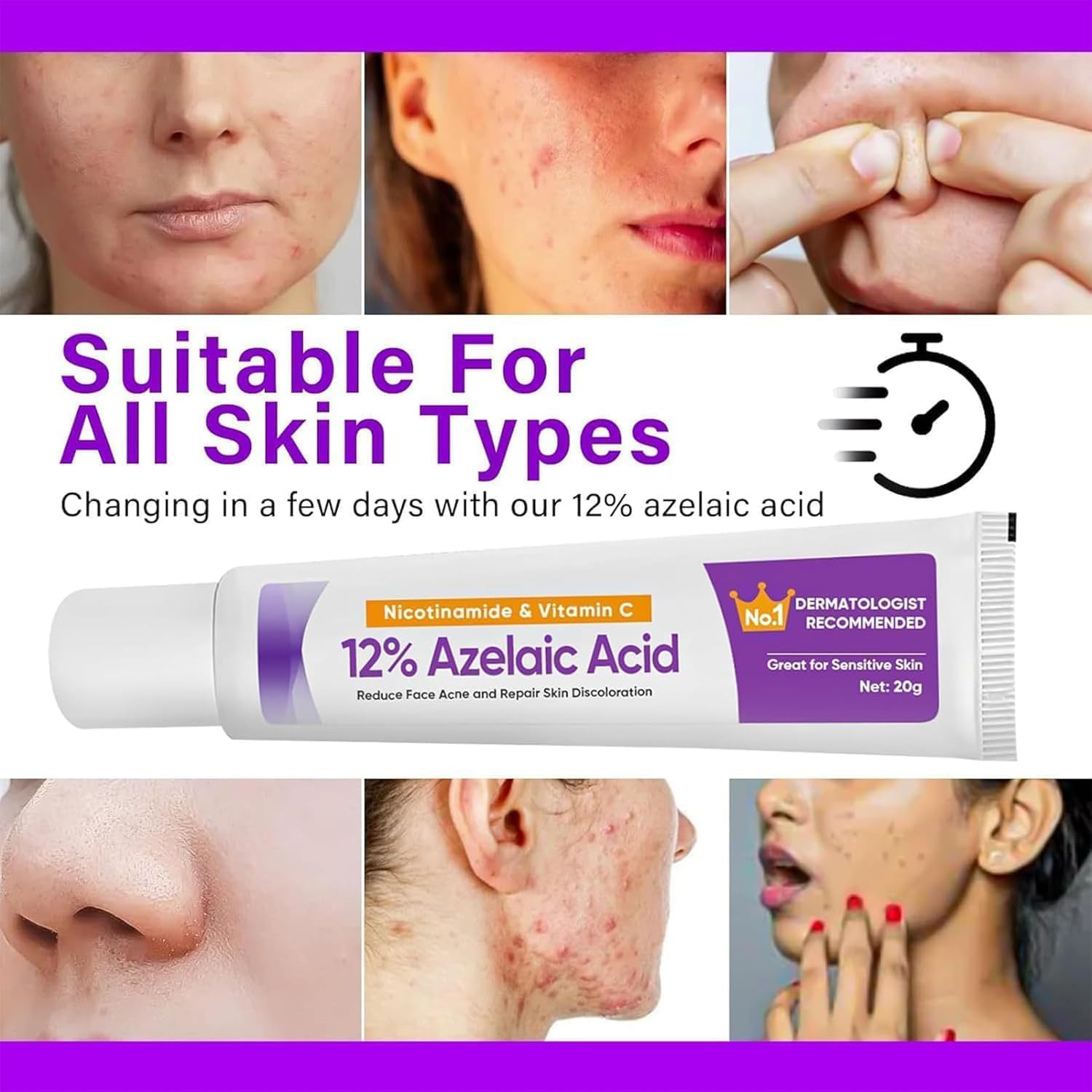 HIQUAY Azelaic Acid Serum, 12% Azelaic Acid Enhancer Cream, Hyaluronic Acid Serum and Niacinamide Facial Treatment, For Redness, Dark Spots, Rosacea, And Pore Cleansing (1 Pcs)